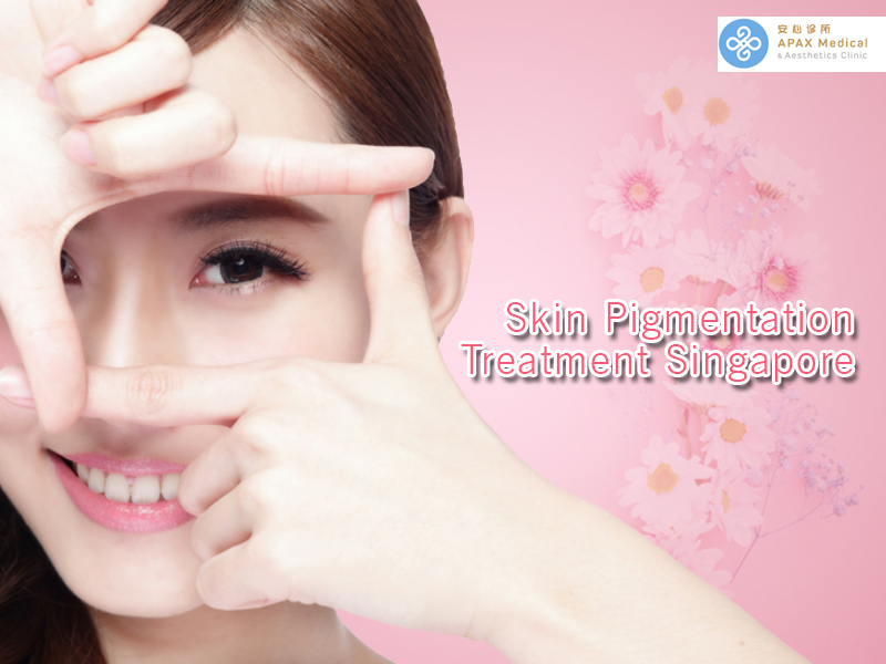 Skin pigmentation treatment Singapore